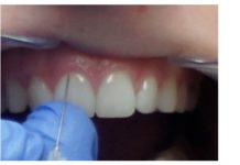 Moderne Zahnarztpraxis in Mosonmagyarovar bietet perfekte Voraussetzungen für Angstpatienten