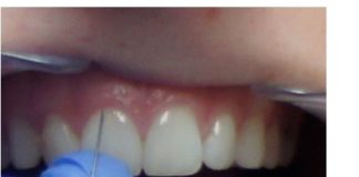 Moderne Zahnarztpraxis in Mosonmagyarovar bietet perfekte Voraussetzungen für Angstpatienten