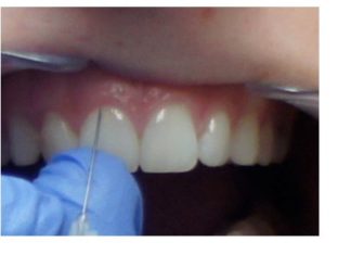 Moderne Zahnarztpraxis in Mosonmagyarovar bietet perfekte Voraussetzungen für Angstpatienten