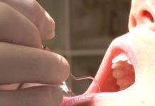 Zahlen deutsche Krankenkassen die ungarische Zahnbehandlung?