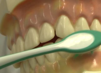 25. September Tag der Zahngesundheit – Auch in Ungarischen Zahnkliniken