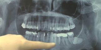 Corona-Massnahmen bei Arztbesuchen wieder entschärft