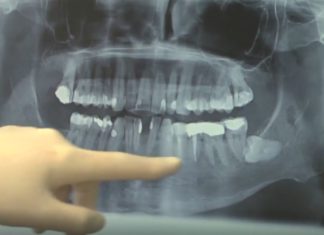 Liveschalte in Zahnklinik: Zahnbehandlung in Pandemiezeiten überhaupt möglich?